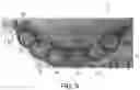 Fig. 08 - Autonomously growing implantable device