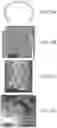 Fig. 15 - Autonomously growing implantable device