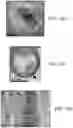 Fig. 16 - Autonomously growing implantable device
