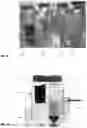 Fig. 15 - Infused particles