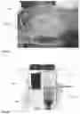 Fig. 14 - Infused demineralized bone fibers