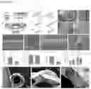 Fig. 05 - IMPLANTABLE VASCULAR GRAFTS