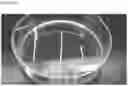Fig. 09 - IMPLANTABLE VASCULAR GRAFTS