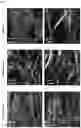 Fig. 06 - Aligned porous fibrillar scaffold for tissue engineering and surgical application