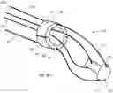 Fig. 05 - Drug eluting insert for implantable body