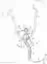 Fig. 01 - Catheter and Method for Inducing Negative Pressure in a Patient's Bladder