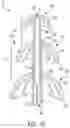 Fig. 11 - Catheter and Method for Inducing Negative Pressure in a Patient's Bladder