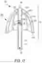 Fig. 12 - Catheter and Method for Inducing Negative Pressure in a Patient's Bladder
