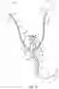 Fig. 13 - Catheter and Method for Inducing Negative Pressure in a Patient's Bladder