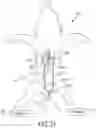 Fig. 22 - Catheter and Method for Inducing Negative Pressure in a Patient's Bladder