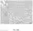 Fig. 25 - Catheter and Method for Inducing Negative Pressure in a Patient's Bladder