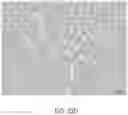 Fig. 27 - Catheter and Method for Inducing Negative Pressure in a Patient's Bladder