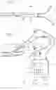 Fig. 05 - Anti-Extravasation Catheter