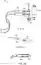 Fig. 06 - Apparatus and methods to create posterior compression at the breast during expression of breast milk