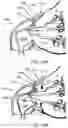 Fig. 22 - Apparatus and methods to create posterior compression at the breast during expression of breast milk