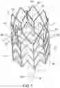 Fig. 08 - IMPLANTABLE INTRAVASCULAR VENTRICULAR ASSIST DEVICE