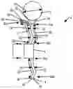 Fig. 01 - Implantable fluid management system for treating heart failure