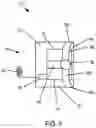 Fig. 04 - Implantable fluid management system for treating heart failure