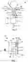 Fig. 05 - Implantable fluid management system for treating heart failure
