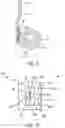 Fig. 07 - Implantable fluid management system for treating heart failure