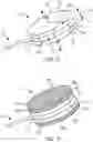 Fig. 09 - Implantable fluid management system for treating heart failure