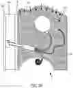 Fig. 14 - Implantable fluid management system for treating heart failure