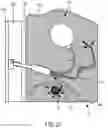Fig. 15 - Implantable fluid management system for treating heart failure