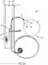 Fig. 18 - Implantable fluid management system for treating heart failure