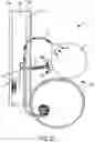 Fig. 19 - Implantable fluid management system for treating heart failure