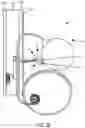 Fig. 20 - Implantable fluid management system for treating heart failure