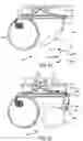 Fig. 22 - Implantable fluid management system for treating heart failure
