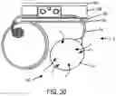 Fig. 23 - Implantable fluid management system for treating heart failure