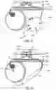 Fig. 24 - Implantable fluid management system for treating heart failure