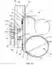 Fig. 26 - Implantable fluid management system for treating heart failure