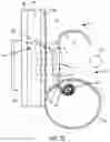 Fig. 27 - Implantable fluid management system for treating heart failure