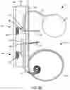Fig. 28 - Implantable fluid management system for treating heart failure
