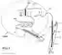 Fig. 02 - Cannula, ECMO assistance system