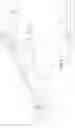 Fig. 03 - Cannula, ECMO assistance system