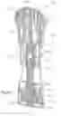 Fig. 24 - Palm activated drug delivery device