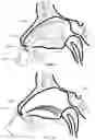Fig. 02 - Nasal Delivery Device and Methods of Use
