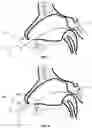 Fig. 06 - Nasal Delivery Device and Methods of Use