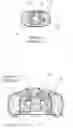 Fig. 10 - Airway management device and method of manufacture