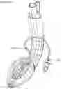 Fig. 16 - Airway management device and method of manufacture