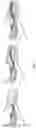 Fig. 09 - Intubation stylets