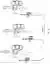 Fig. 11 - Intubation stylets