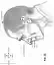 Fig. 09 - Patient interface