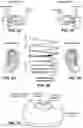 Fig. 18 - Patient interface