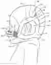 Fig. 01 - HEADGEAR, INTERFACE AND AN ASSEMBLY