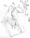 Fig. 02 - Devices and methods related to medical tubes