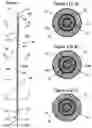 Fig. 02 - GUIDE WIRE-CATHETER ASSEMBLY
